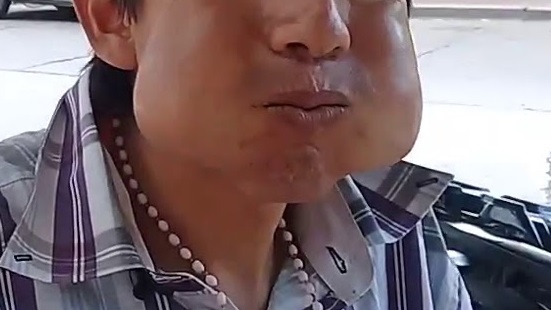 Imagen de coquero.