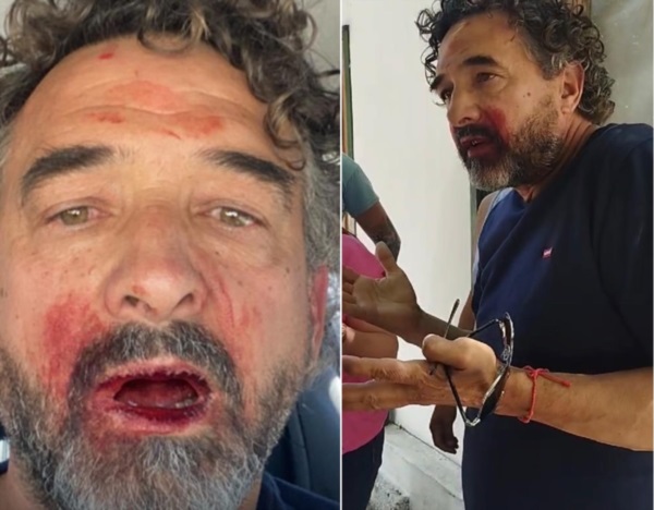 Albaini, tras la agresión.