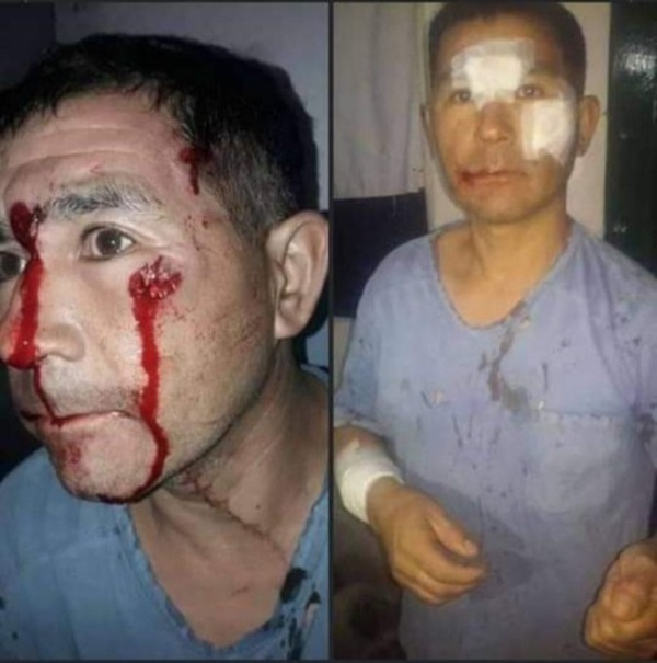 Gabriel Fredes, vecino del barrio INTA, víctima de la violencia policial en pandemia.