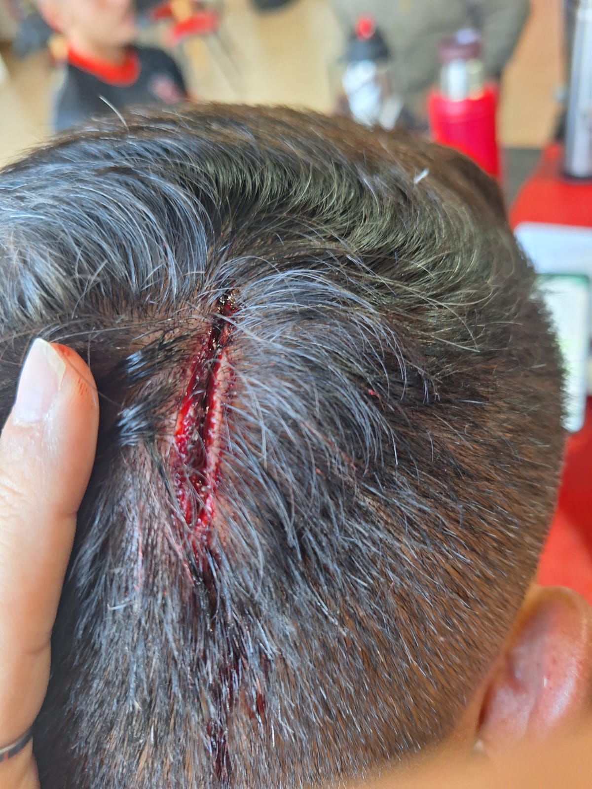 Una de las heridas sufridas por Flores.