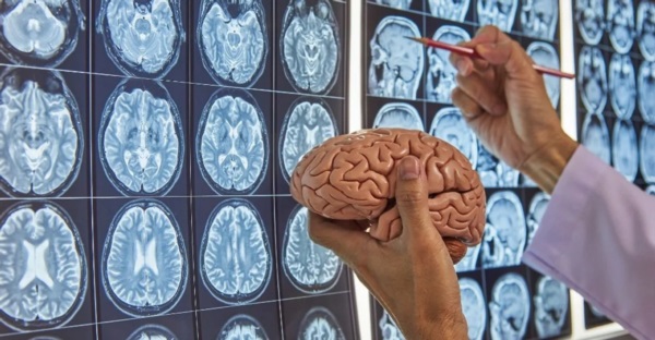 Avanza vacuna contra el glioblastoma.