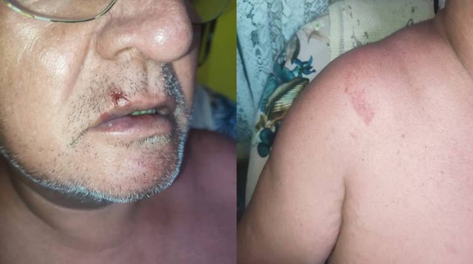 El hombre debió ser atendido tras los golpes. (Imagen: TN)