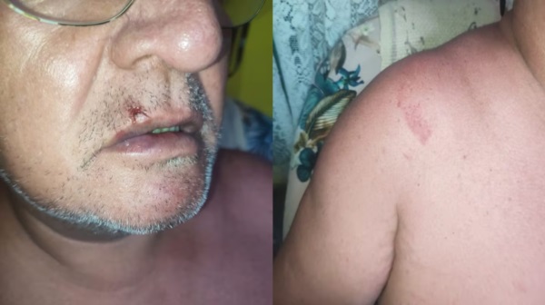 El hombre debió ser atendido tras los golpes. (Imagen: TN)