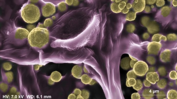 Cepas del hongo Fusarium oxysporum no solo pueden captar oro en sus alrededores, sino que le es posible integrarlo a su estructura. Imagen Xataka