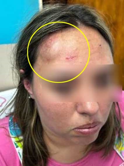 La vicedirectora sufrió un empujón contra la pared y se golpeó la cabeza.
