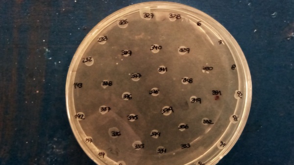 Se analizó la presencia de bacterias resistentes a metales pesados y antibióticos en aves.