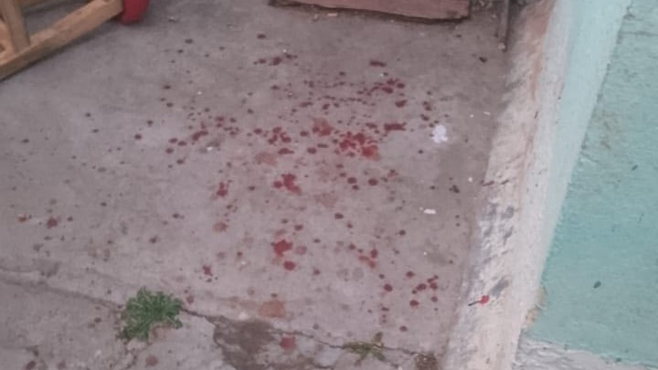 Manchas hemáticas en el patio de la vivienda donde ocurrió la agresión.