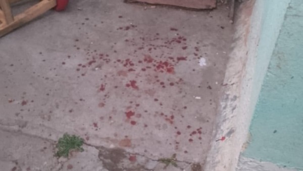 Manchas hemáticas en el patio de la vivienda donde ocurrió la agresión.