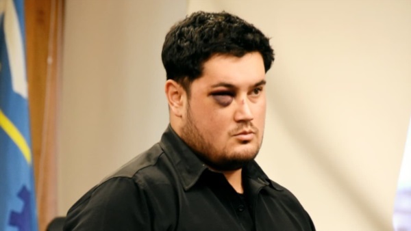 Golpeado en el piso, Hernán Curaqueo reaccionó con un machete.