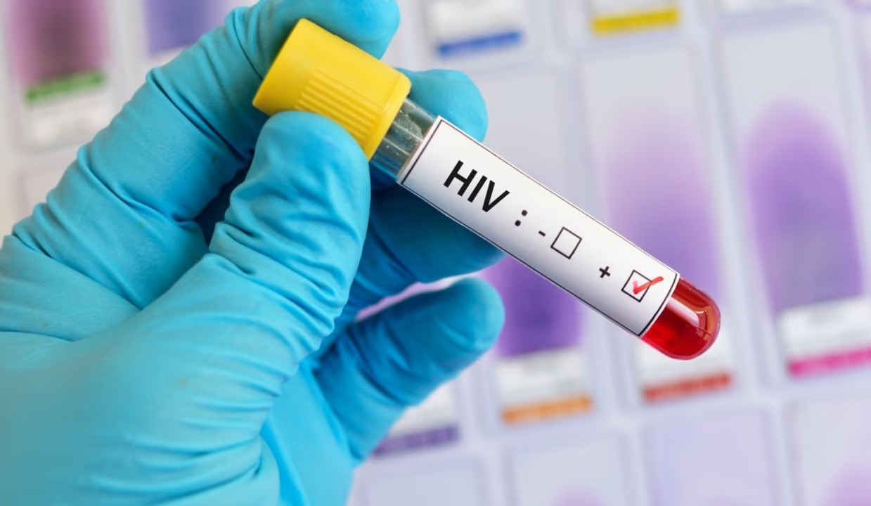 El test de VIH es gratuito en el sistema público de salud y en obras sociales y prepagas.