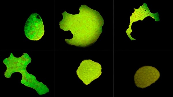 Microscopía de fluorescencia de un ensayo con aptámeros con una proteína del SARS-CoV-2. Foto: Agencia NA (CONICET).