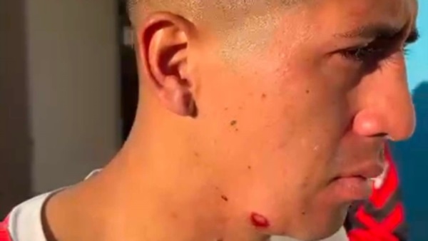 Ernesto Armoa. Foto: Huracán de Comodoro Rivadavia.