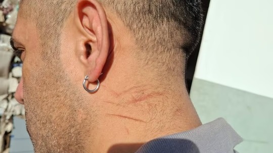 Navarro presentaba rasguños en el cuello y la nuca compatibles con lesiones defensivas de la damnificada.