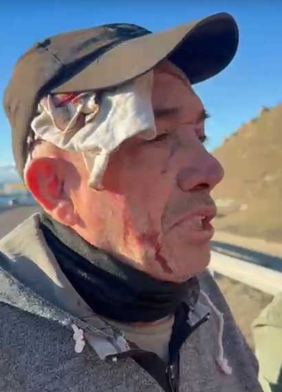 Manuel, uno de los heridos del accidente.